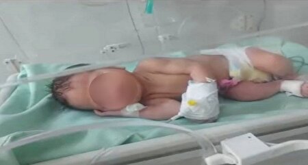 تازه ترین وضعیت نوزاد پیدا شده در سطل زباله‌ نازی آباد