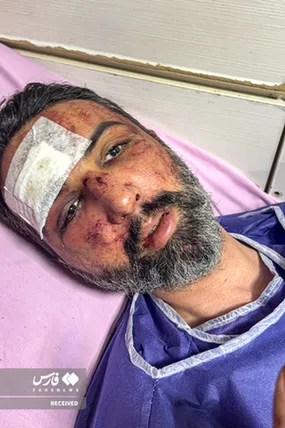 فکر کردند مرده‌ام، رهایم کردند